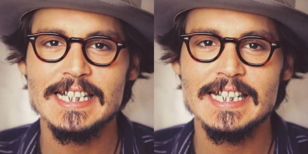 Johnny Depp Teeth: Gold Veneers/Crowns