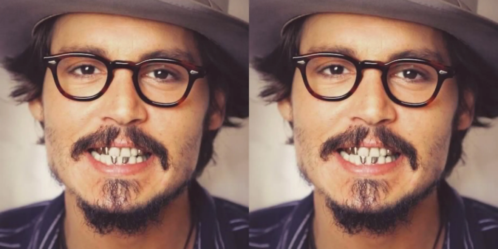 Johnny Depp's Teeth A Dental Perspective Web DMD