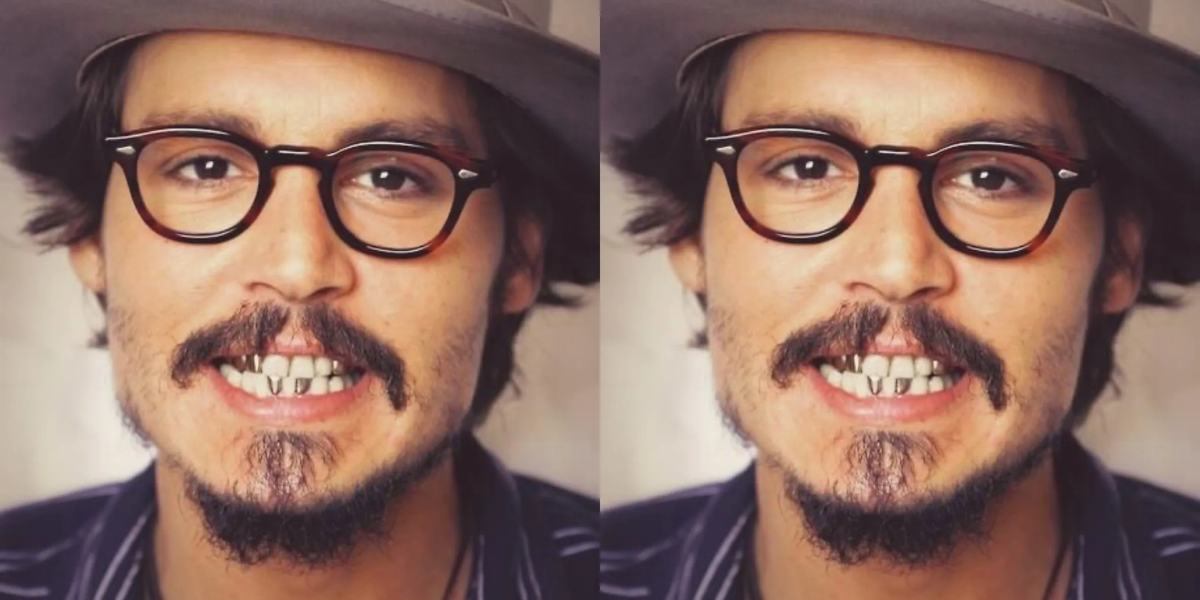 Johnny Depp's Teeth A Dental Perspective Web DMD