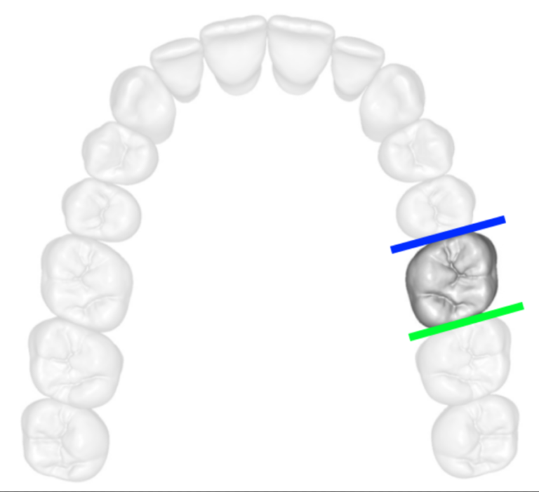 Teeth Surfaces Dental Terminology  DMD