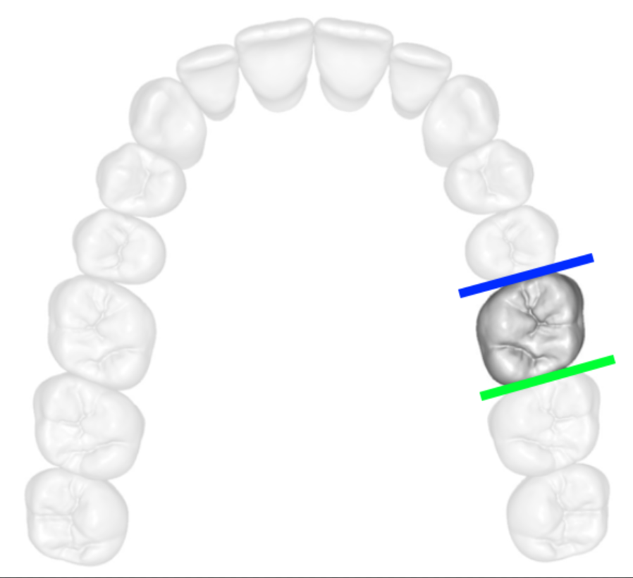 Teeth Medical Terminology at Ruby Sale blog