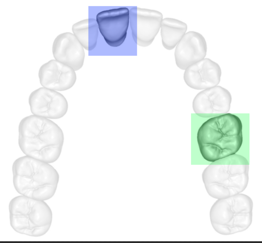 Teeth Surfaces: Occlusal and Incisal