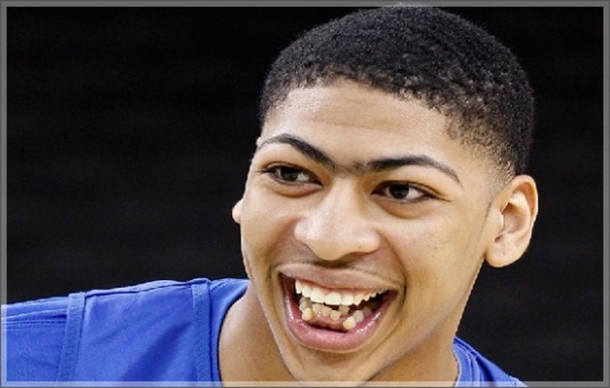 Девис. Anthony Davis Teeth. Зубы Anthony Davis. Энтони Дэвис бровь. Дэвис монобровь.