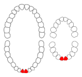 Mandibular (Lower) Central incisors
