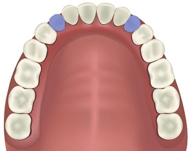 What are Canine Teeth