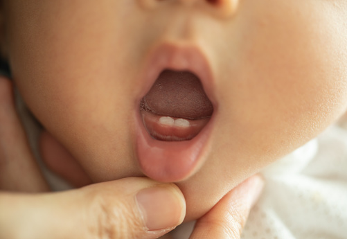 Do Baby Teeth Have Roots?