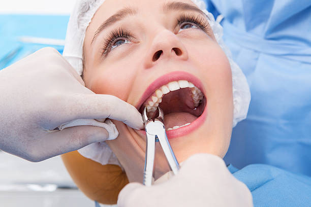 Root Canal vs Extraction: Which is Best for You?