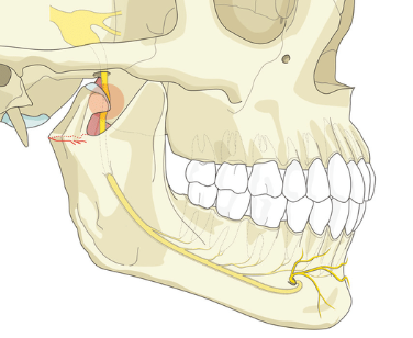 Inferior Alveolar Nerve