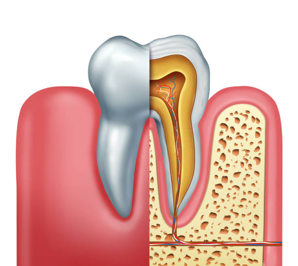 Root Canals: A Full Breakdown