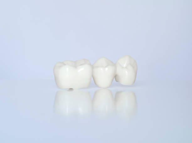 Ceramic Dental Crown