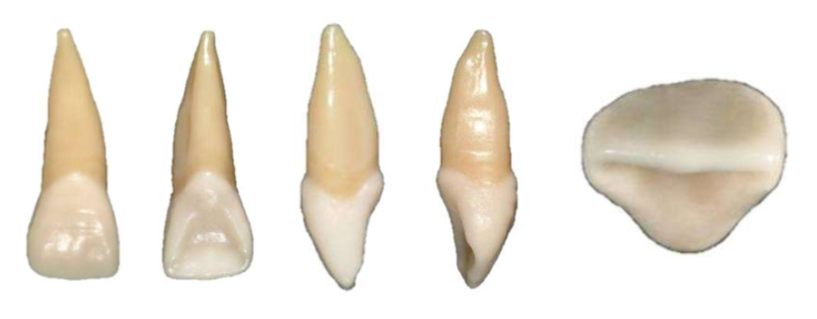 Maxillary (Upper) Central incisors Outside of Mouth