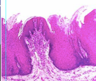 Fungiform Papillae: Fungus-like 