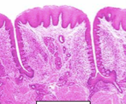 Foliate Papillae: Leaf-like 