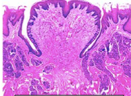 Circumvallate Papillae: