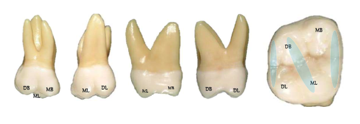 Maxillary First Molar Real Teeth