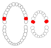Maxillary Second Molar Diagram