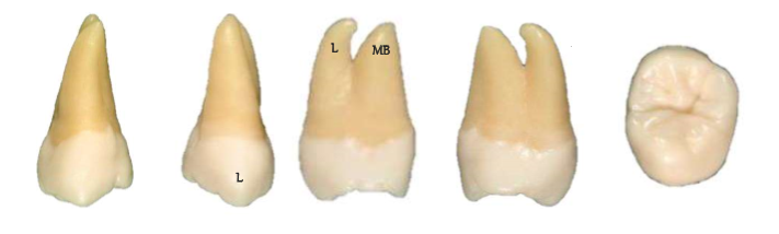 Maxillary Third Molar Real Teeth
