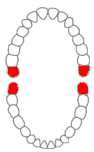 Maxillary Third Molar Diagram