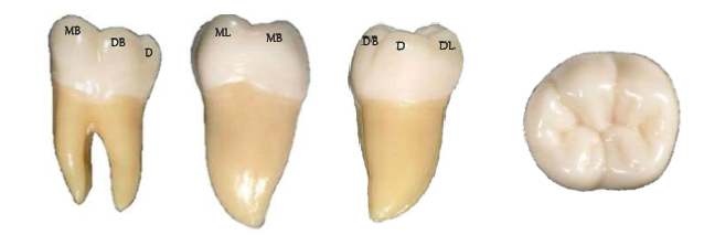 Mandibular First Molar Real Tooth
