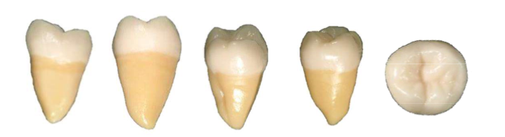 Mandibular Third Molar Real Teeth