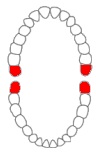 Mandibular Third Molar Diagram