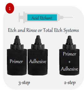 Total Etch System for Teeth Etching