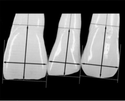 Tooth Dimensions (Length:Width Ratio)