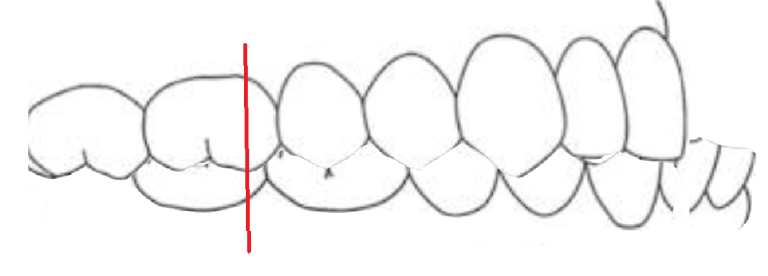 Dental Occlusion: How Your Teeth Fit Together - Web DMD