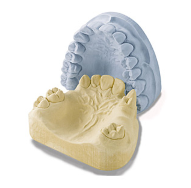 Gypsum Model of Teeth