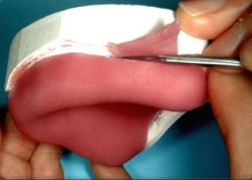 Shaping a Custom Dental Tray