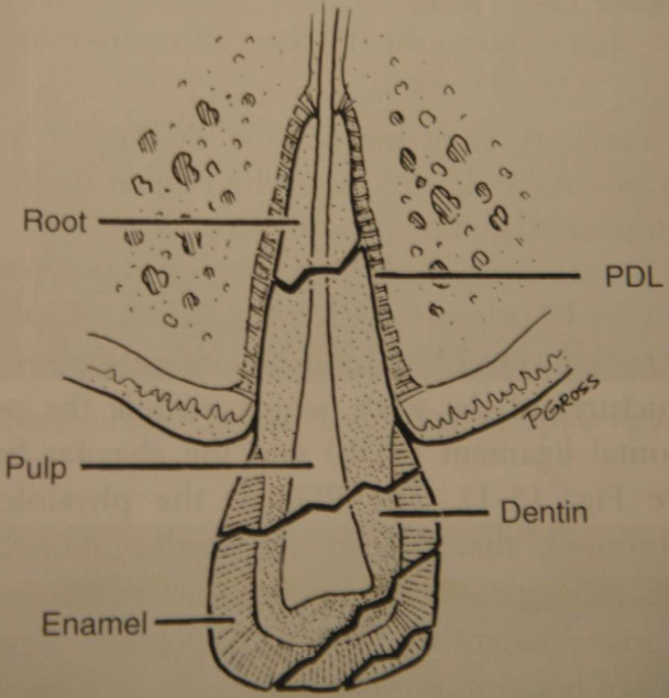 Tooth Fracture Types