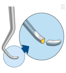 Curette