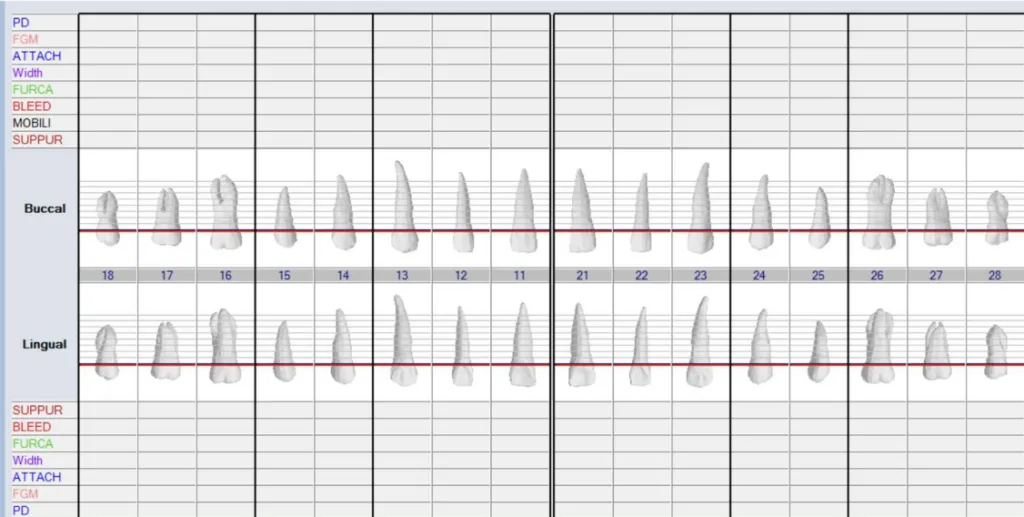 Periodontal Charting